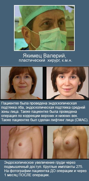 Хирург по коррекции груди Хирург по коррекции груди